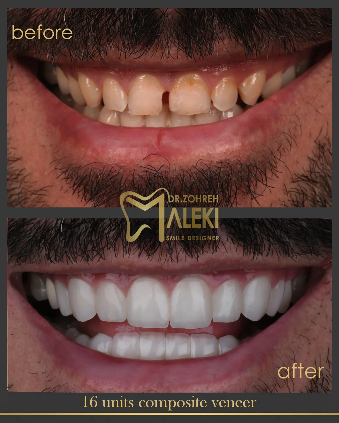 composite1.jpg