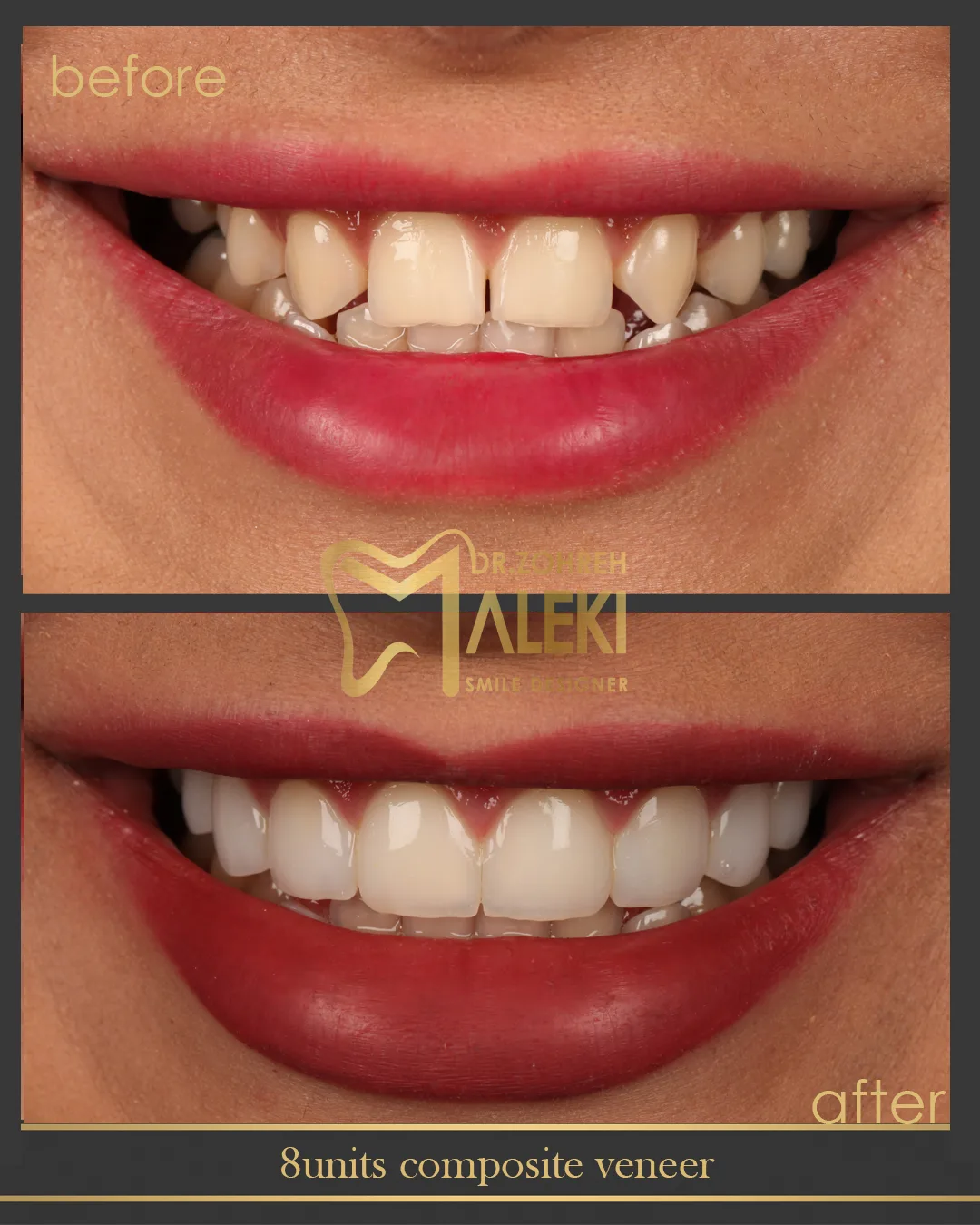 composite3.jpg